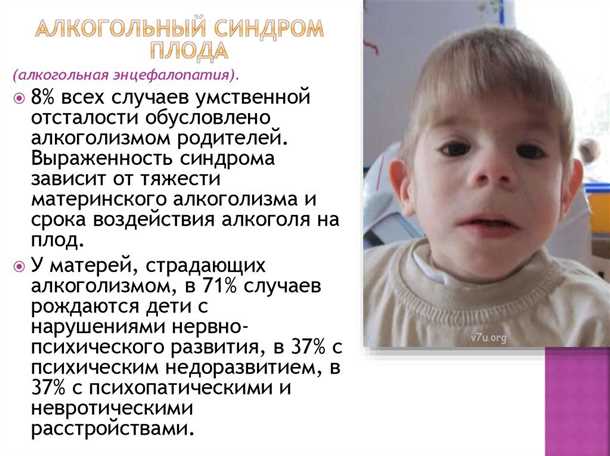 Генетическая предрасположенность