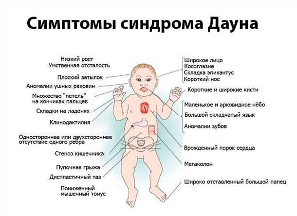 Детский синдром нарушений реакции на температурные изменения.