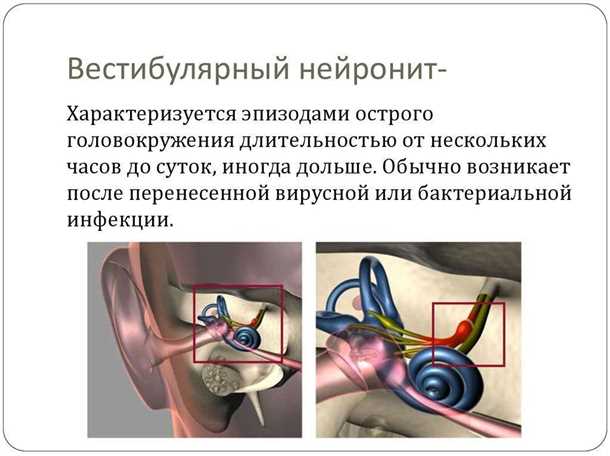 Детский синдром нарушений вестибулярного аппарата.