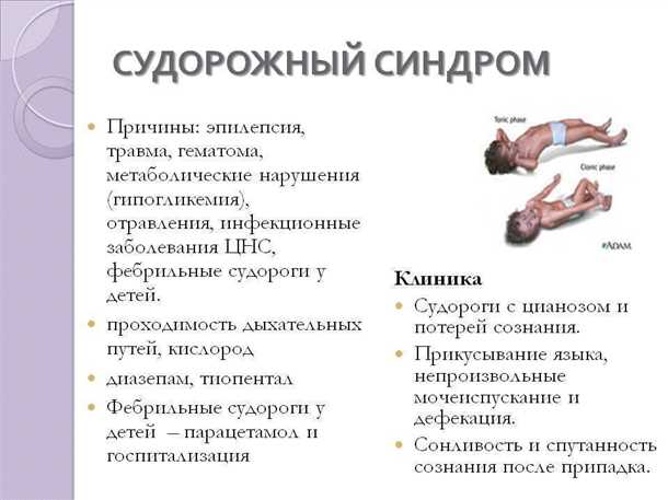 Детский судорожный синдром.