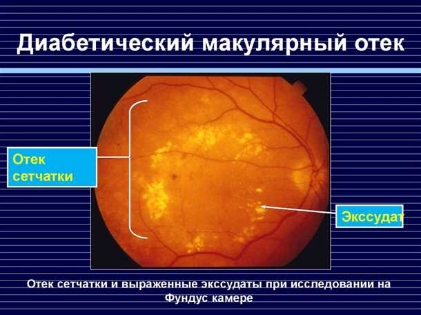 Лазерное лечение
