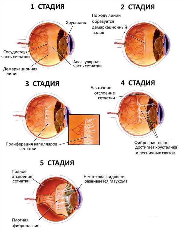 Принцип работы