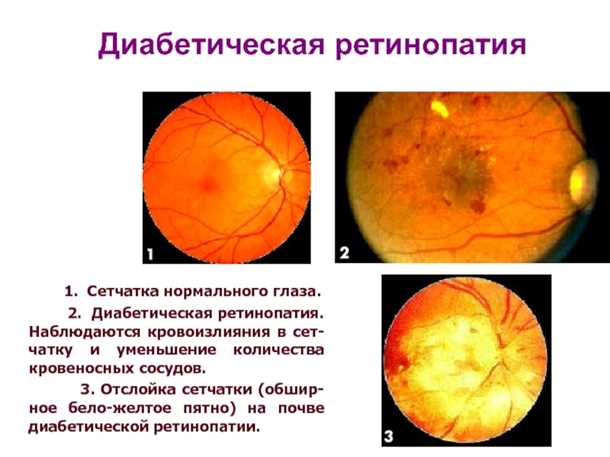 Фондоскопия в диагностике