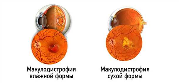 Ультразвуковая диагностика ВМД