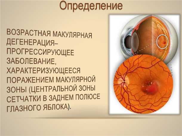 Оптическая когерентная томография (ОКТ)