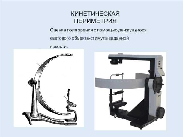 Что такое динамическая периметрия глаза?