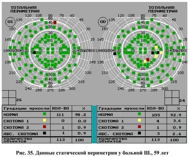 1. Высокая точность измерений