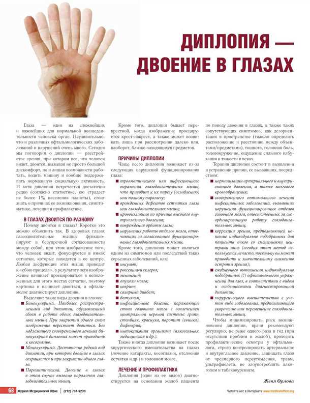  Как проводится диагностика диплопии? 