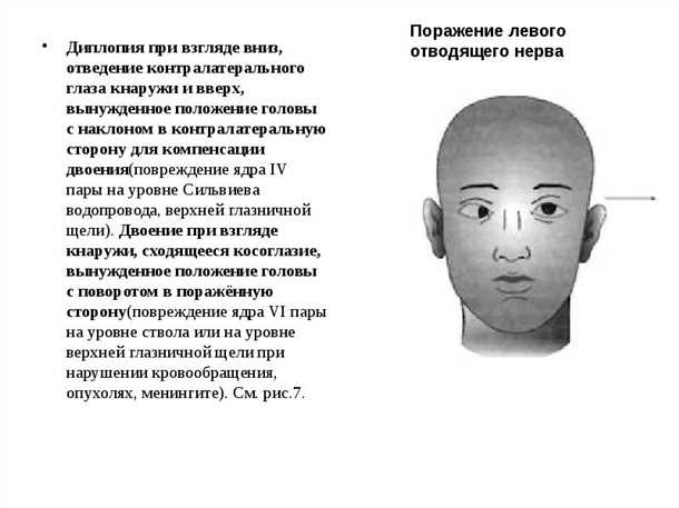 Диплопия или двоение, симптомы, причины, лечение диплопии.