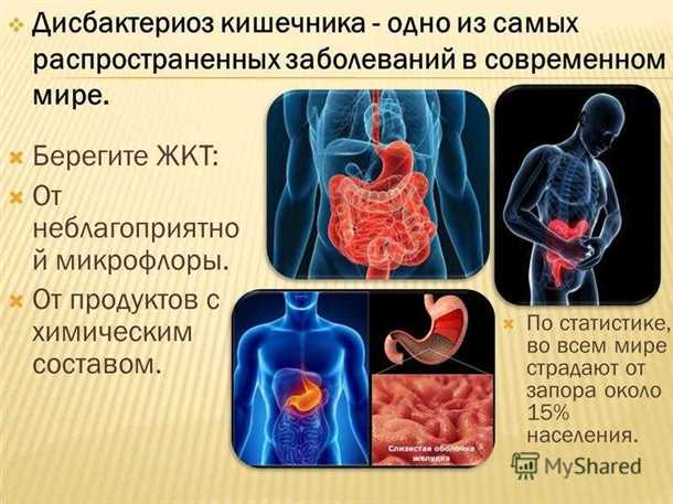 Профилактика дисбактериоза кишечника у детей: основные меры предосторожности