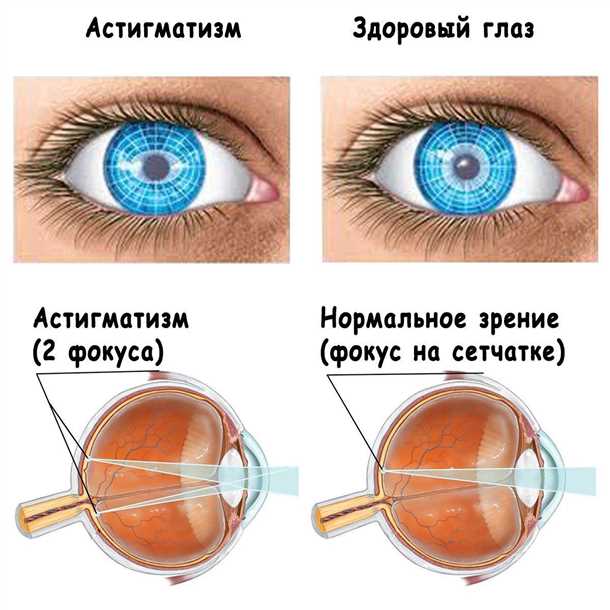 Раздражение и аллергические реакции