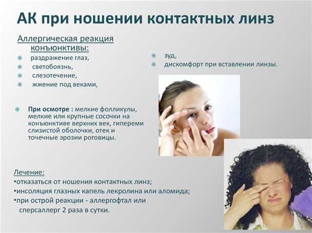 Определение и основные типы