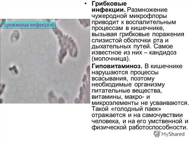 2. Неприятный запах кала