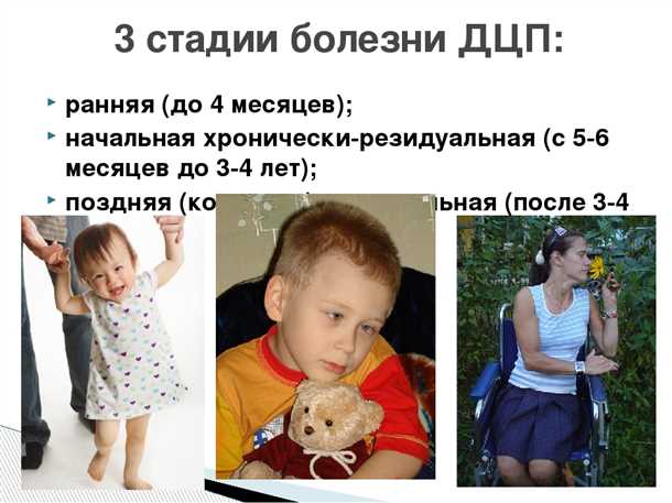 ДЦП с атипичным течением.