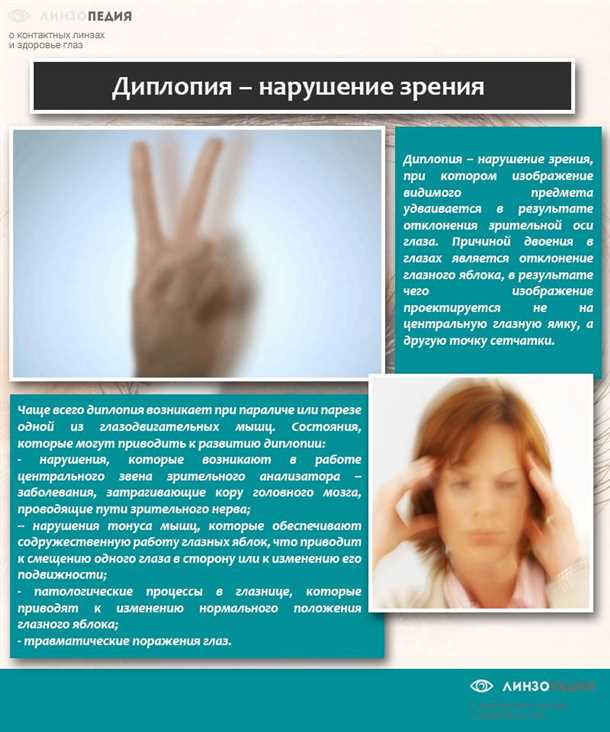 Профилактика двоения в глаза