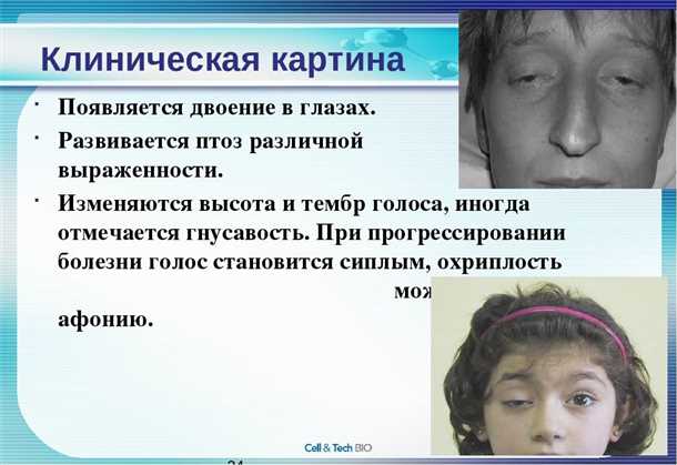 1. Поддерживайте хорошую осанку
