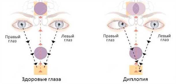 2. Перед сном отдыхайте глаза