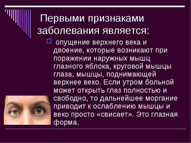 Симптомы двоения в глаза