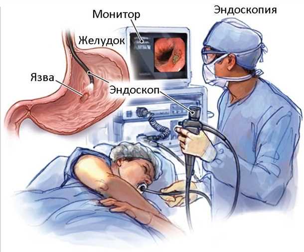 Ограничения эндосонографии: