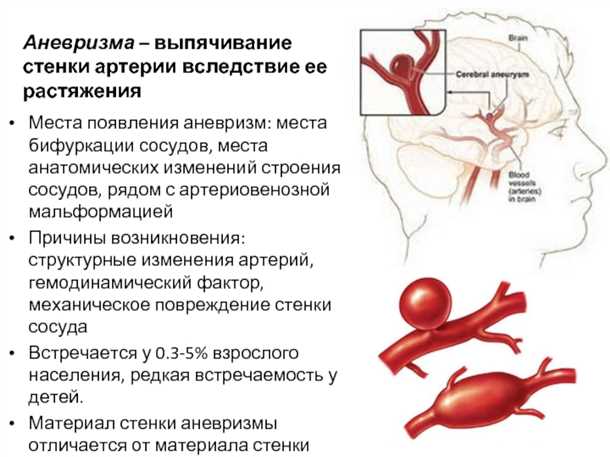 Выбор метода лечения в зависимости от типа аневризмы