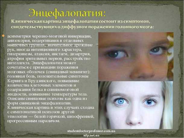 Виды поражения мозга при энцефалопатии