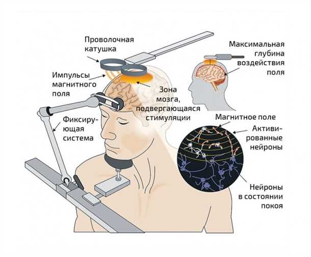 Эпилепсия и дополнительные методы лечения: биофидбэк, транскраниальная магнитная стимуляция.