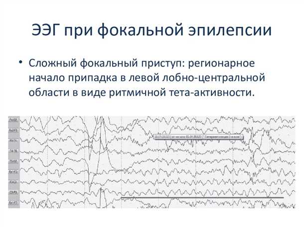 Роль электрофизиологических методов в комплексной диагностике эпилепсии