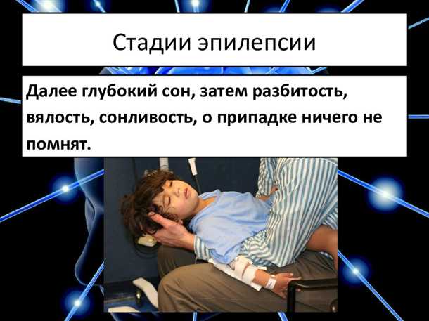 1. Инсомния и ее влияние на эпилептические приступы