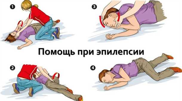 Эпилепсия и путешествия: рекомендации для пациентов, путешествующих с заболеванием.