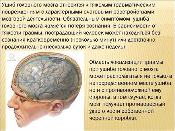 Эпилепсия и травматические повреждения головного мозга: особенности диагностики и лечения.