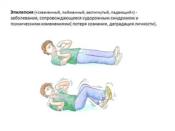 Принципы диагностики эпилепсии у взрослых и детей