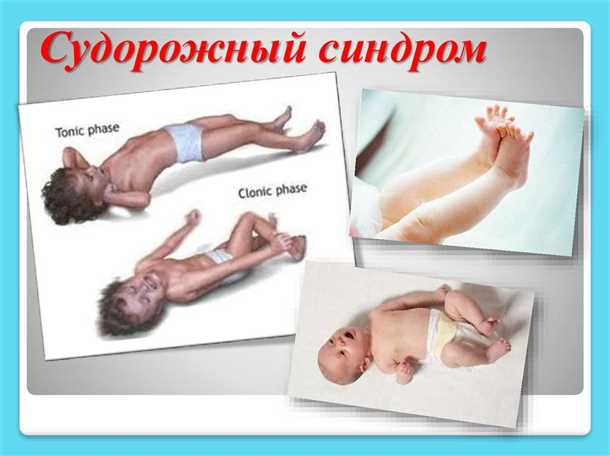 Возможные последствия эпилепсии у детей