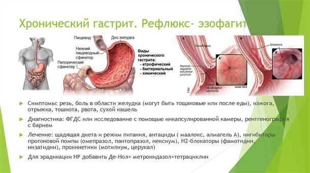 5. Потеря аппетита и похудение