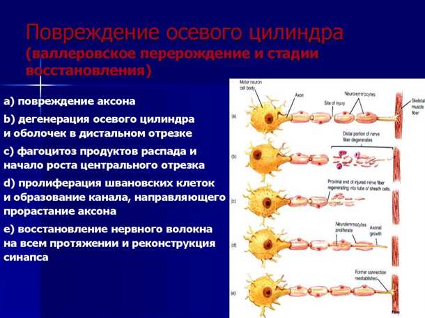 Развитие воспалительных процессов в нервной системе