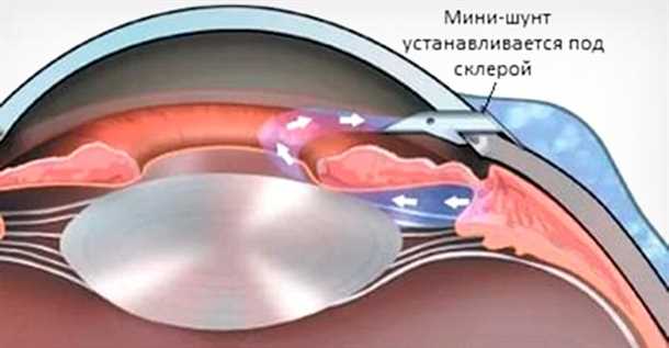 Реабилитационные мероприятия