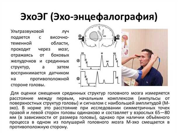 Локализация кровоизлияний и их классификация