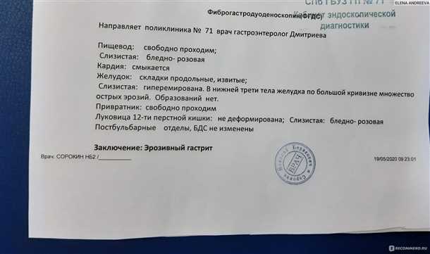 Как долго длится ФГДС?