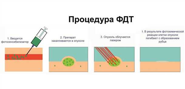 Преимущества применения ФДТ
