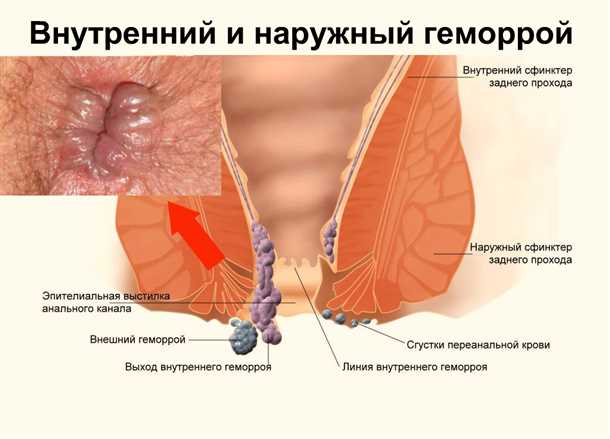 11. Питание, упражнения и изменение образа жизни