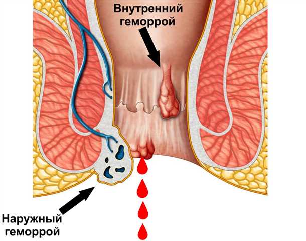 Изменение образа жизни