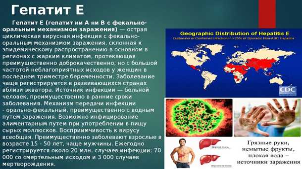 Признаки хронического гепатита E: