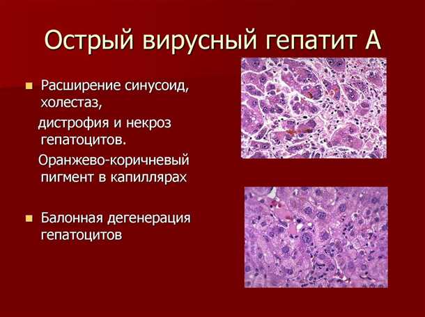 Основные меры профилактики гепатита A: