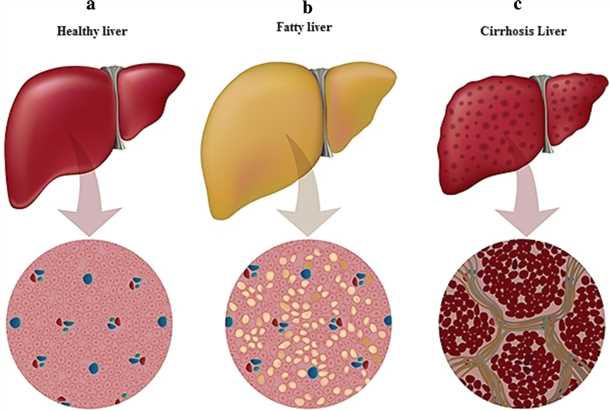 Причины возникновения гепатоза
