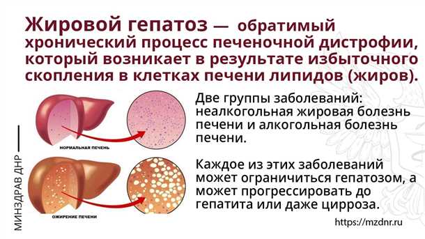 Симптомы и признаки гепатоза