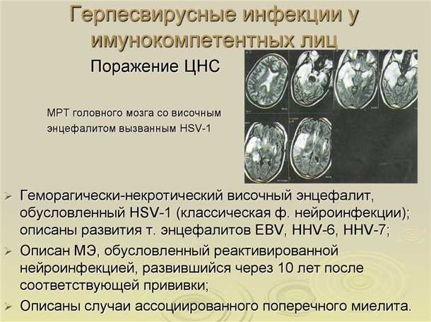 Методы лечения