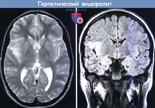 Психологические последствия