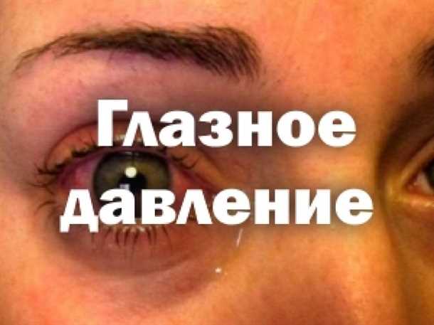 Диагностика и обследование глазного давления