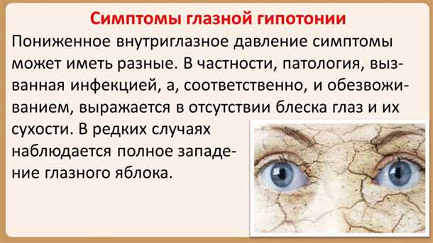 Лечение повышенного глазного давления