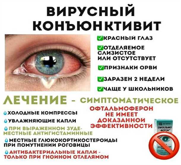 Как предотвратить гнойное воспаление глаз