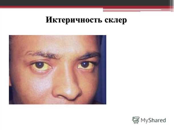 Следуйте правильной диете